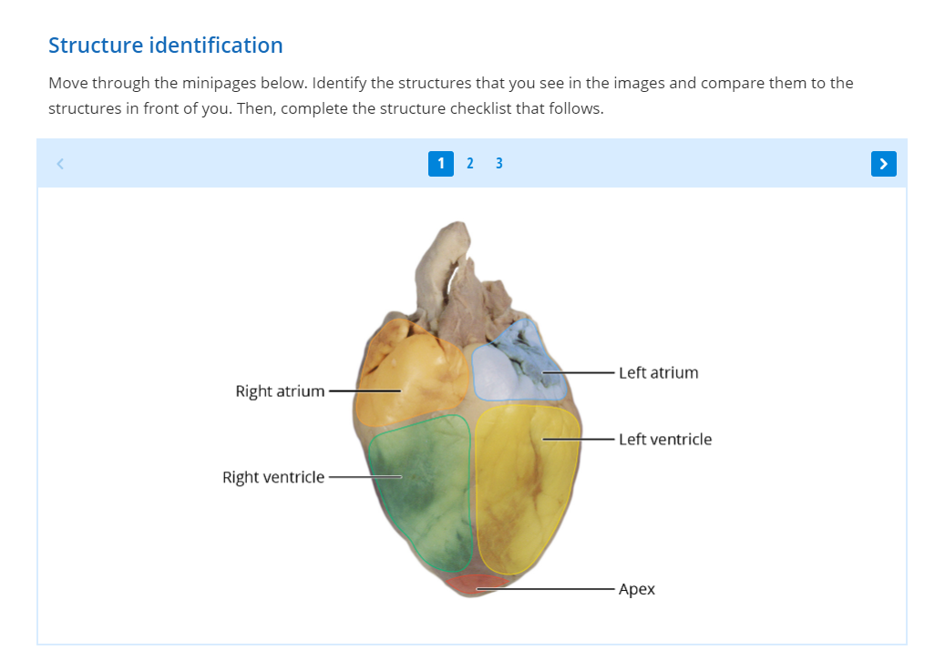 Anterior heart structure identification