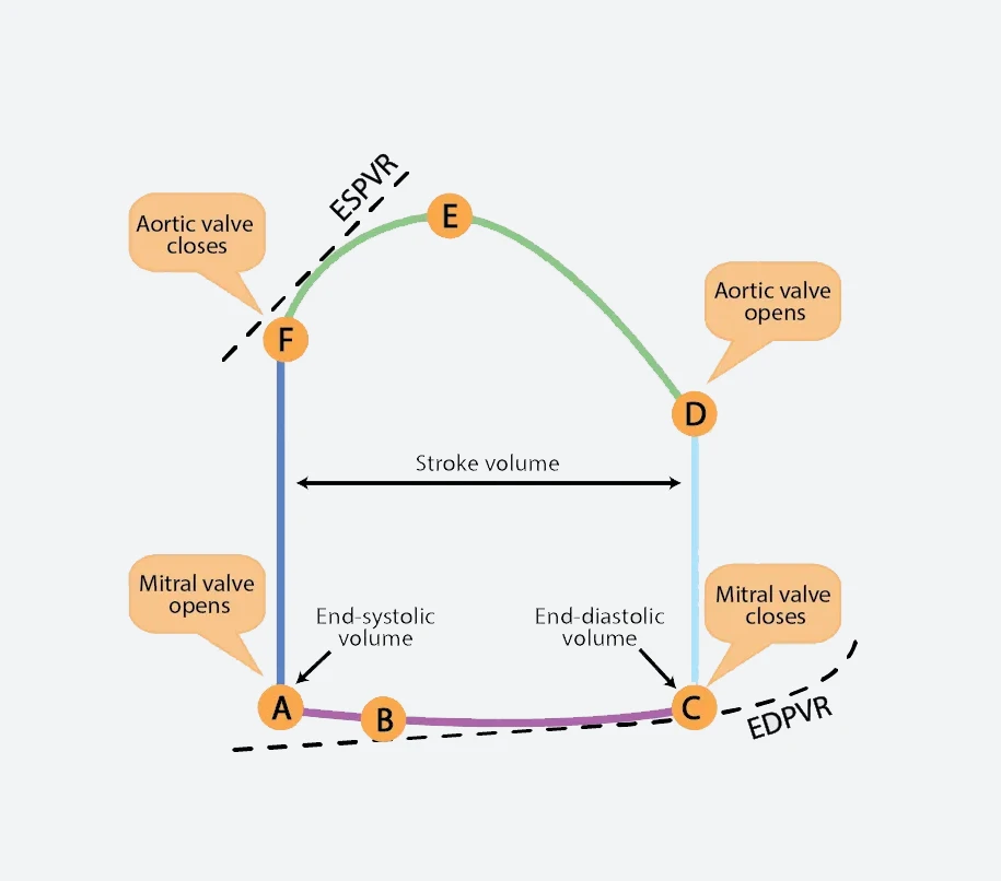 Understanding the points on a PV Loop