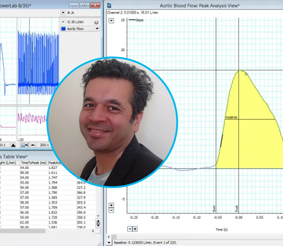 Pressure and flowrate studies in large animals