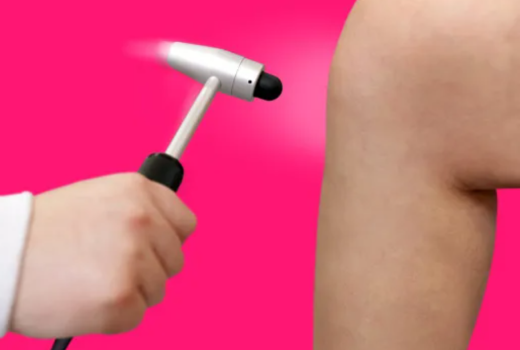 The Myotatic Reflex