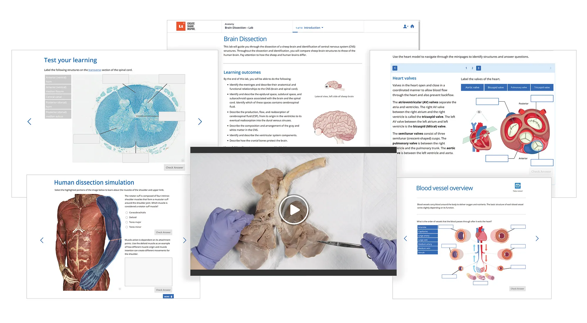 A selection of screenshots showing Lt Anatomy content.