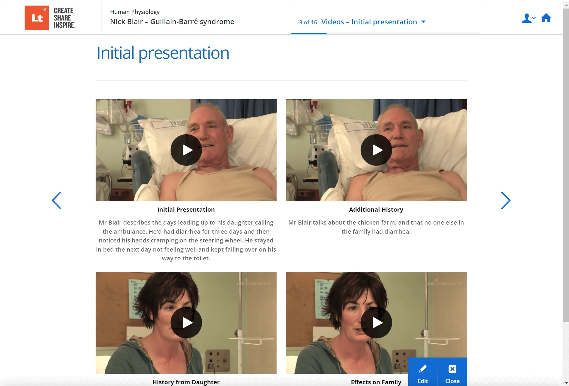 An image of Lt showing a clinical case of Guillain-Barré syndrome.