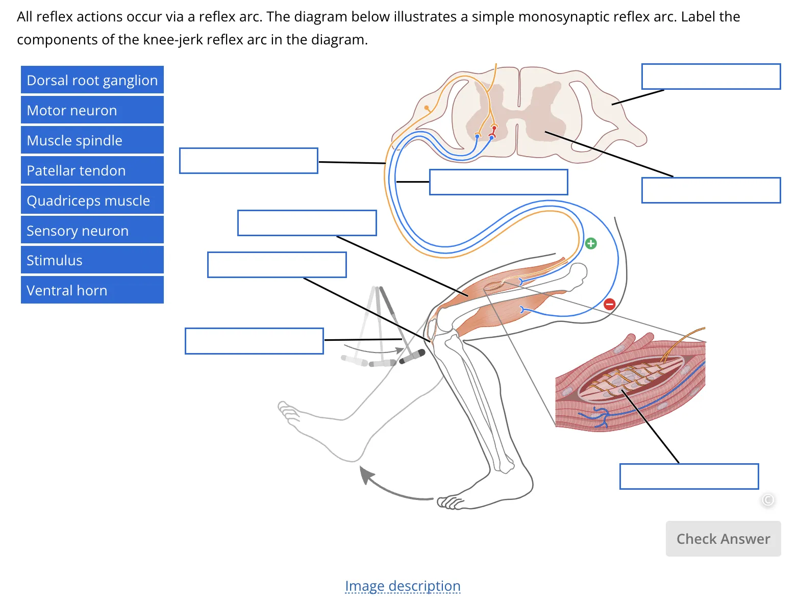 An interactive "drag-and-drop" question in Lt that shows the components of the myotatic reflex.