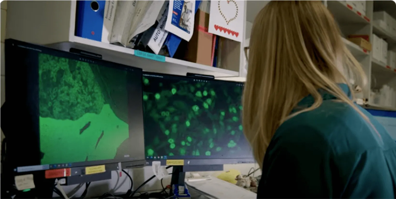A photograph of a blonde person with their back to the camera in an office environment looking at green stained cells on two computer monitors.