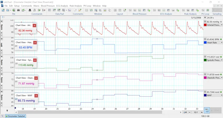 Human nibp labchart screen