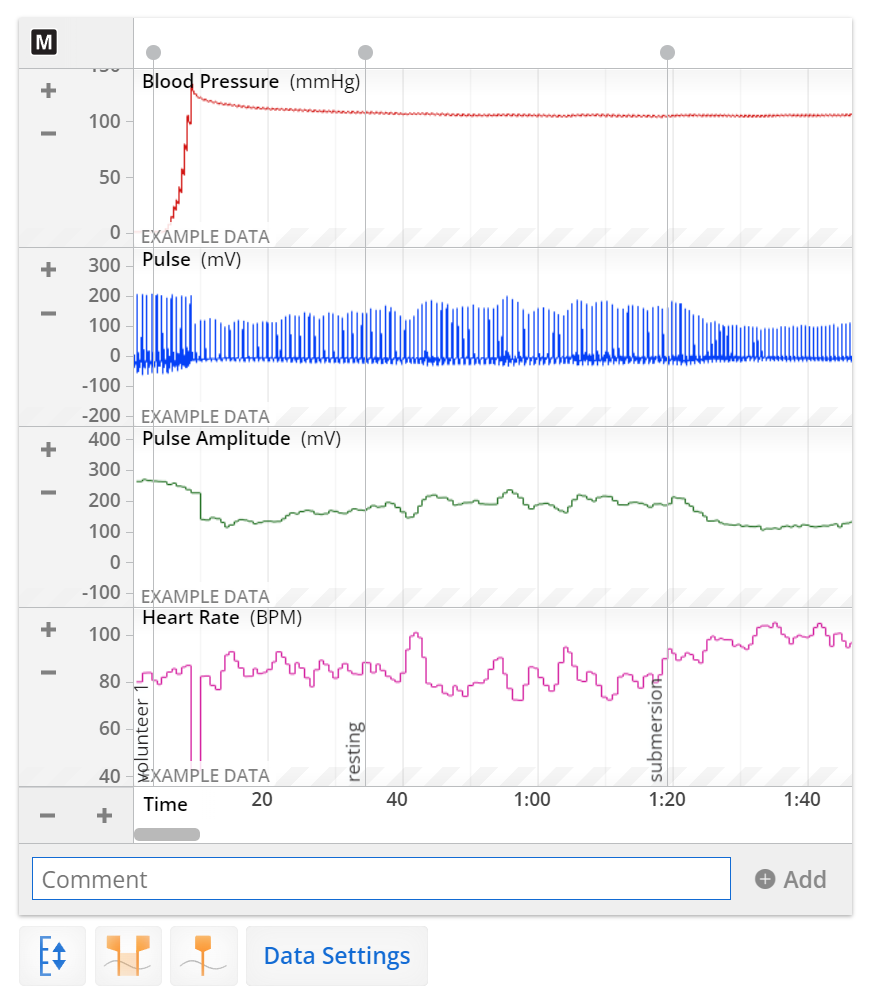 A screenshot of a Data Sampling panel in Lt showing example data across four channels: Blood Pressure, Pulse, Pulse Amplitude, and Heart Rate.