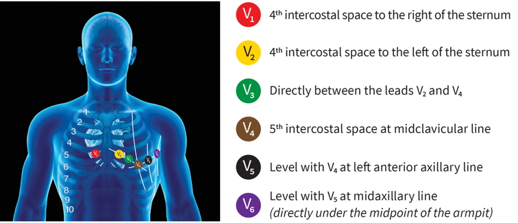 12 Lead ECG placement diagram | V1-V6 | ADInstruments