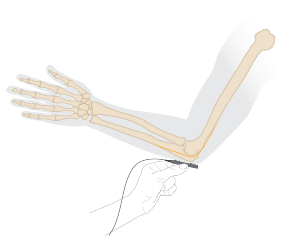 Ulnar nerve muscle twitch | electrode placement elbow | PowerLab | ADInstruments 