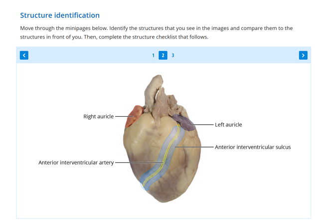 Posterior heart structure identification