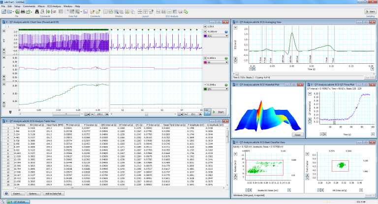 ECG Software | EKG/ECG Data Analysis App | ECG Reader