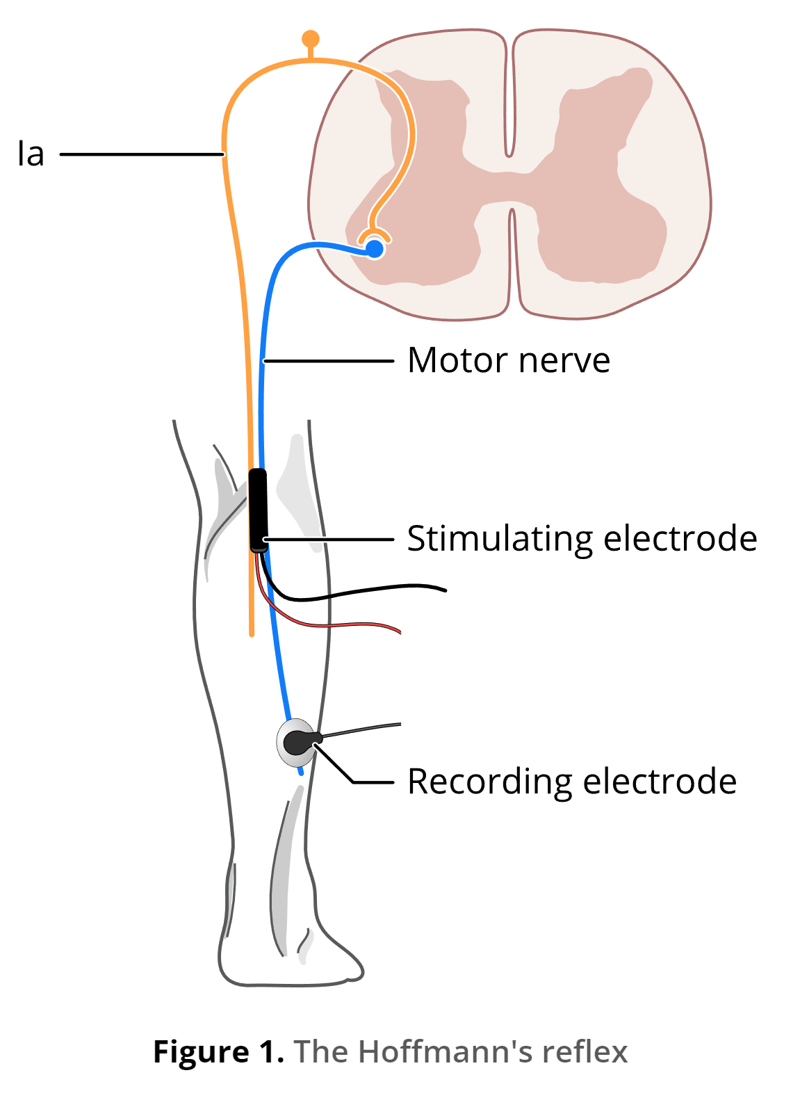 An illustrated diagram showing the key components of the Hoffmann's reflex, including the motor nerve, stimulating electrode, and recording electrode.