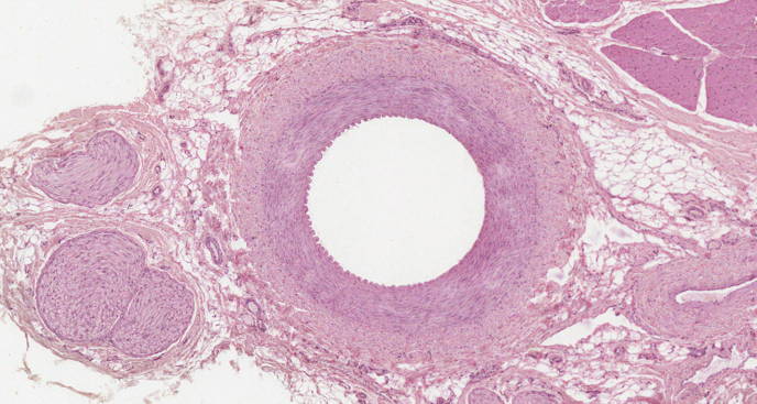 Free anatomy image medium muscular artery macroscopic | Lt | ADI