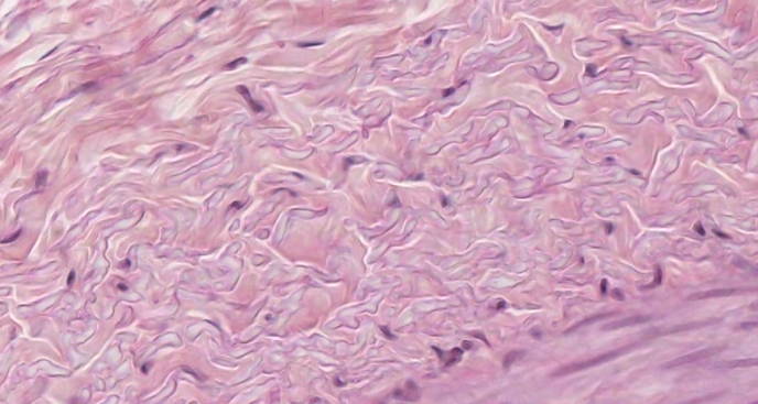 Free anatomy image medium muscular artery tunica externa| Lt | ADI