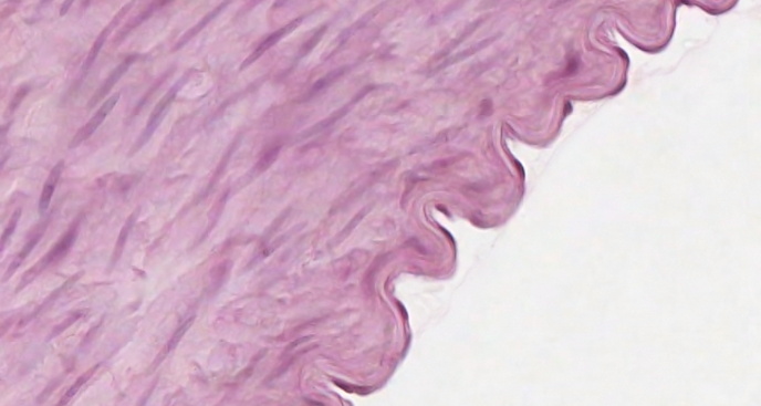 Free anatomy image medium muscular artery tunica intima | Lt | ADI