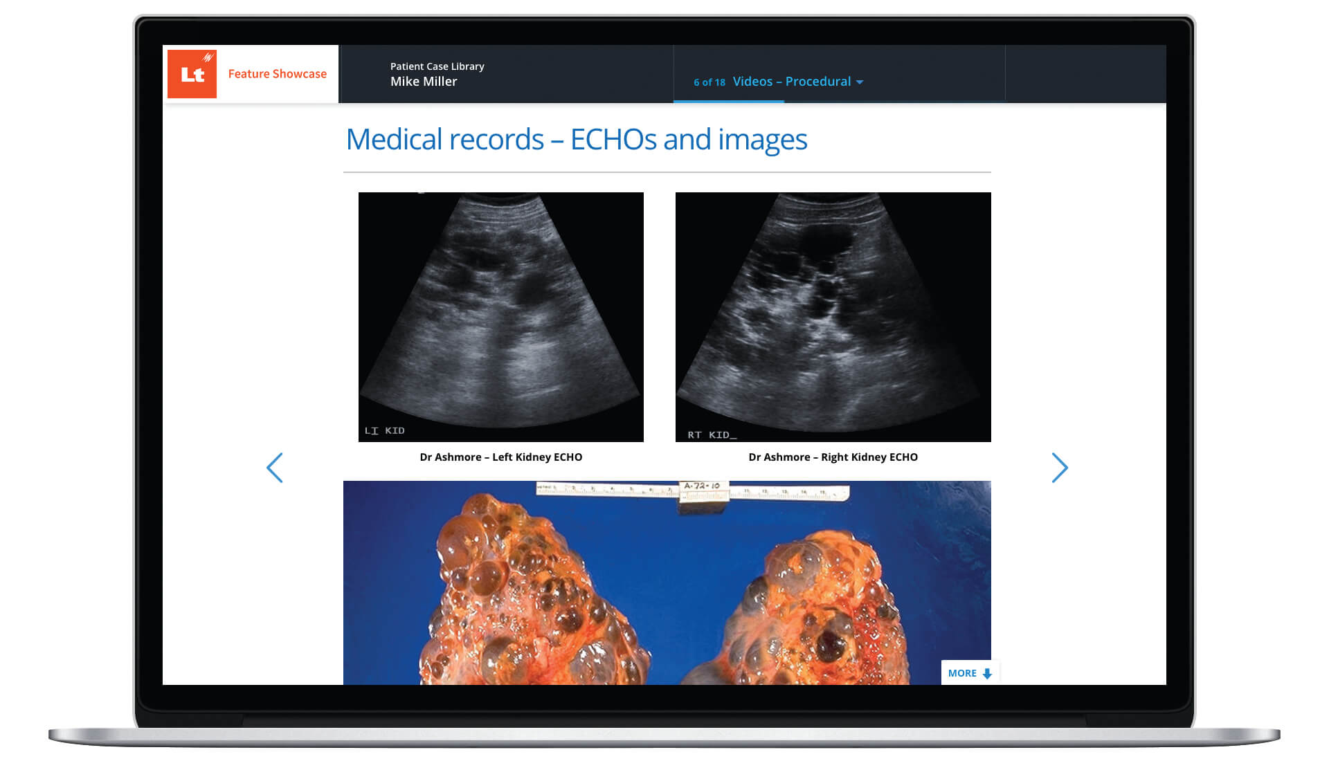 A laptop showing the Lt interface. Medical images are shown ("ECHOS and images").