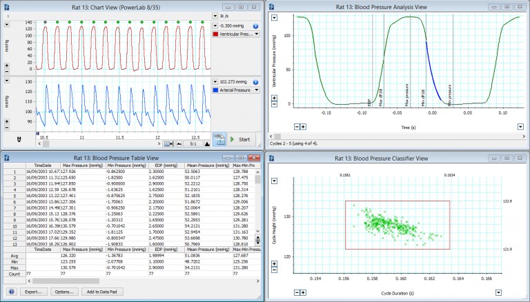 Invasive Blood Pressure | Research software | LabChart ADI
