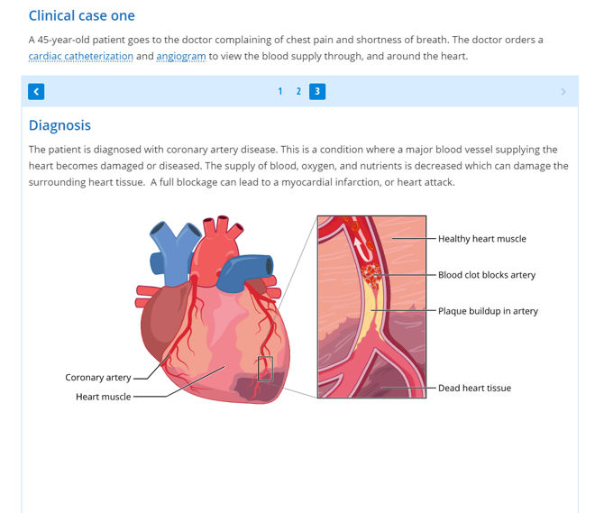 Coronary artery disease diagnosis