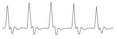 Analog ECG waveform diagram