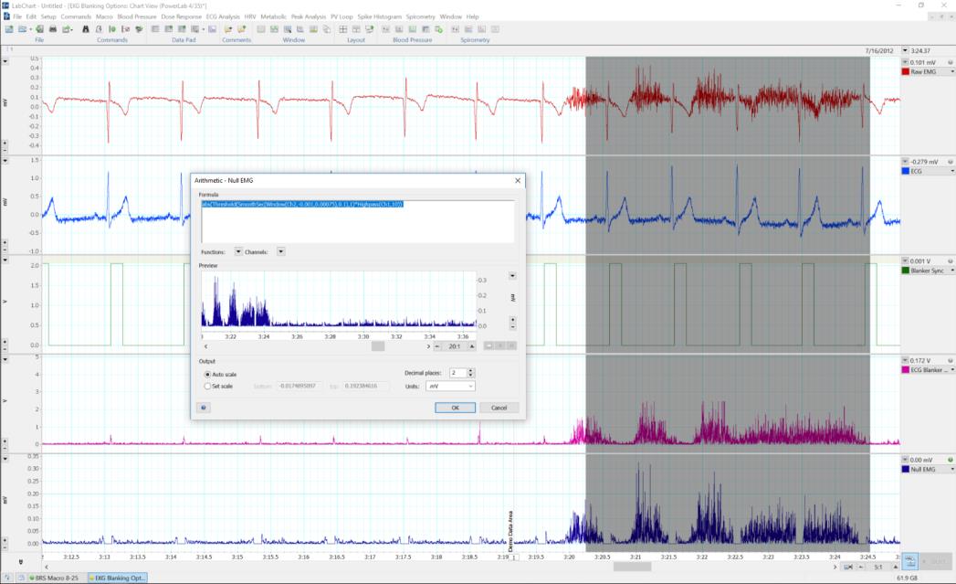 LabChart software for signal artifact rejection