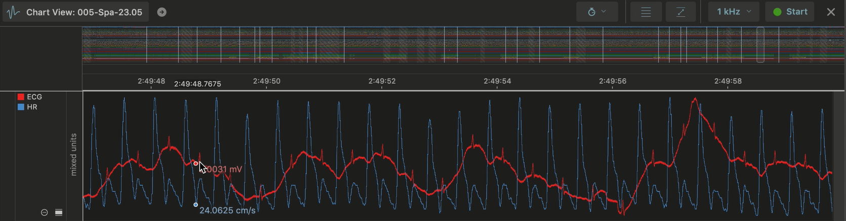 LabChart Lightning (ADI) overlay multiple signals for quantitative data analysis 