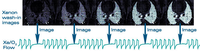 Scan Chart